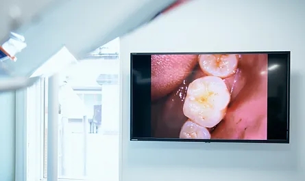 高性能CCDカメラ