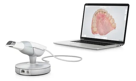 口腔内スキャナー（TRIOS4）