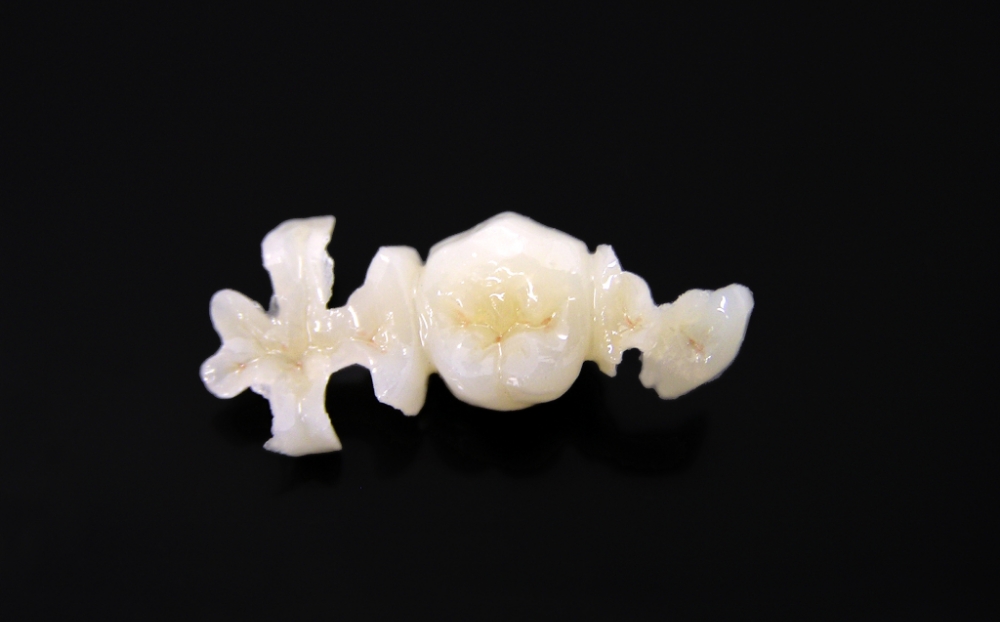 ハイブリッド（自費）