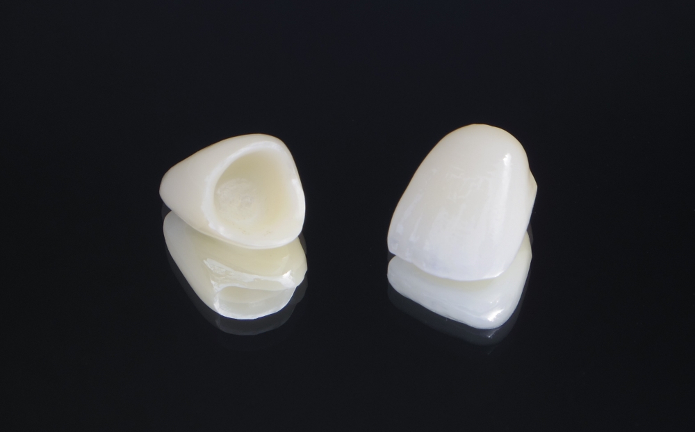 ジルコニアセラミックス（自費）